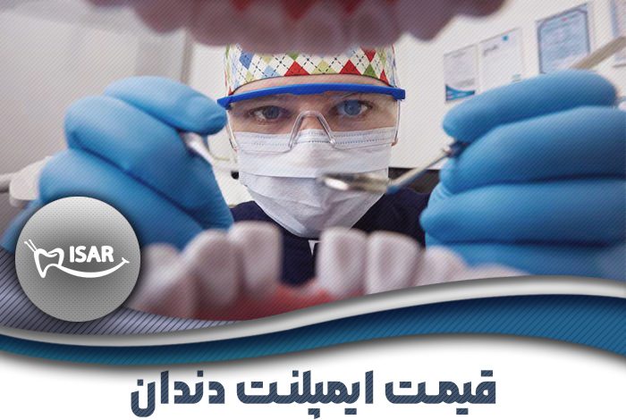 قیمت ایمپلنت دندان